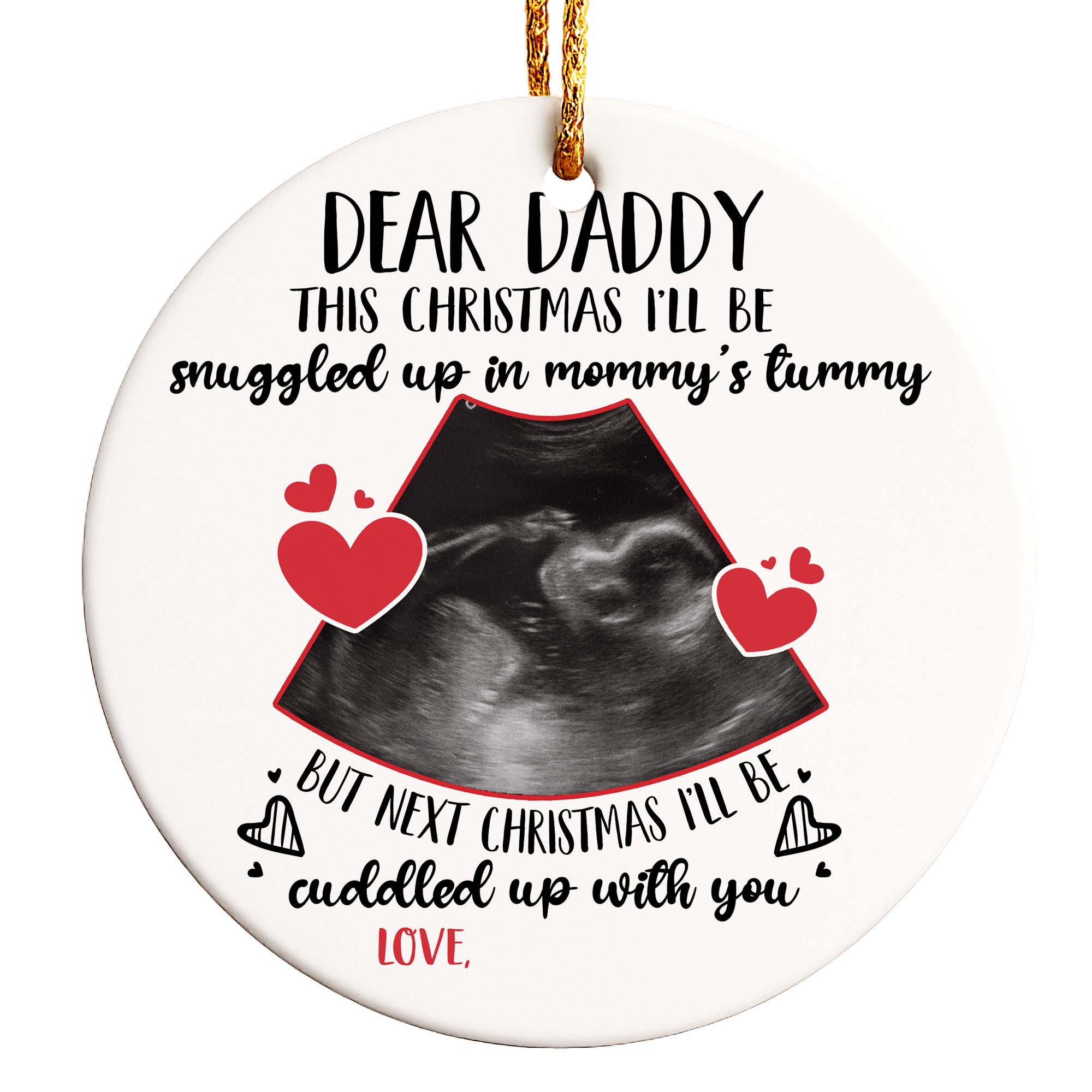 Personalized Dear Daddy Christmas Ornament with Ultrasound Design – Perfect Baby Announcement Gift for Expecting Parents - Image 1