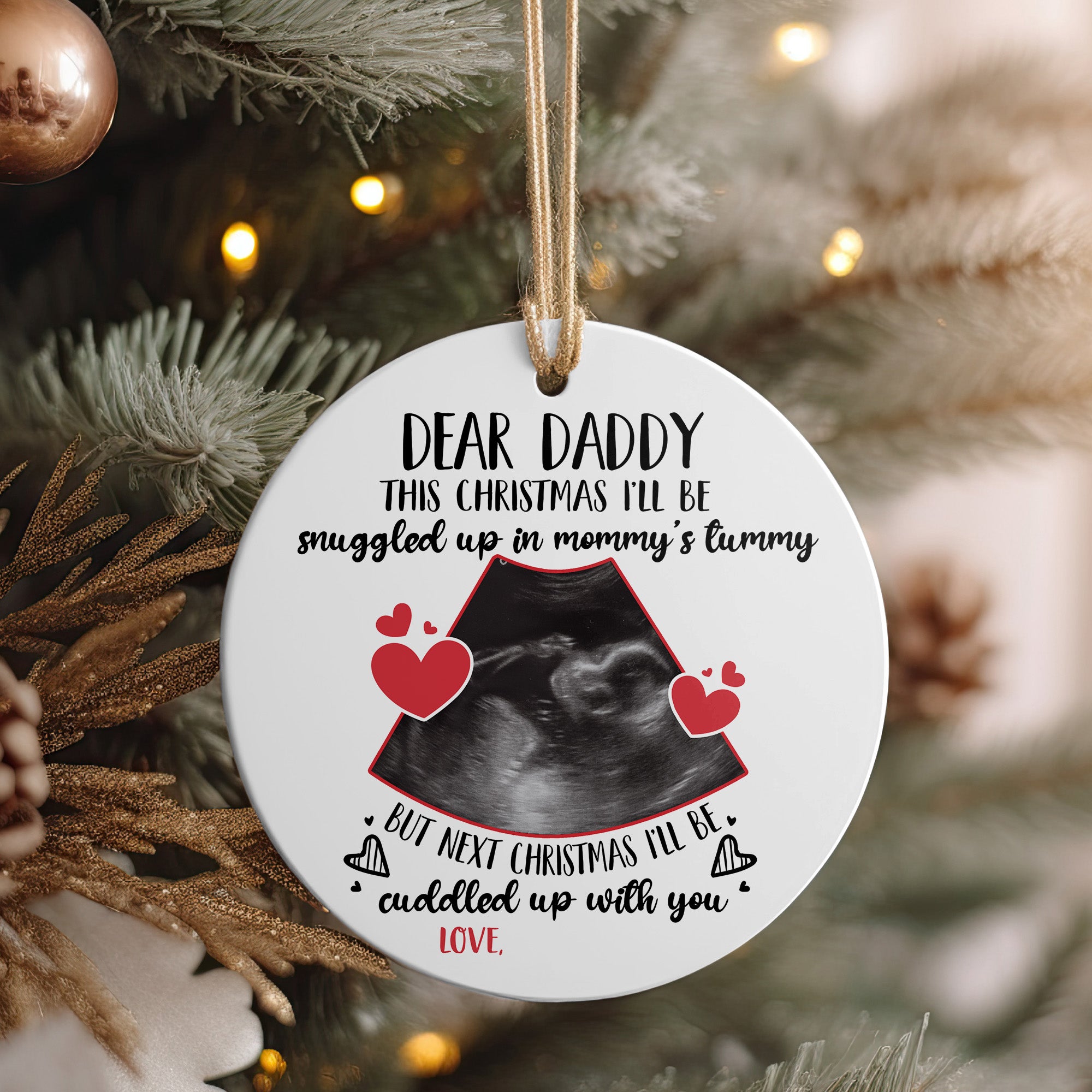 Personalized Dear Daddy Christmas Ornament with Ultrasound Design – Perfect Baby Announcement Gift for Expecting Parents - Image 4